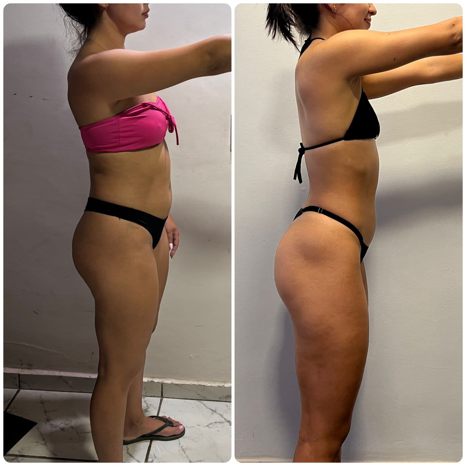 Transformación de Beatriz